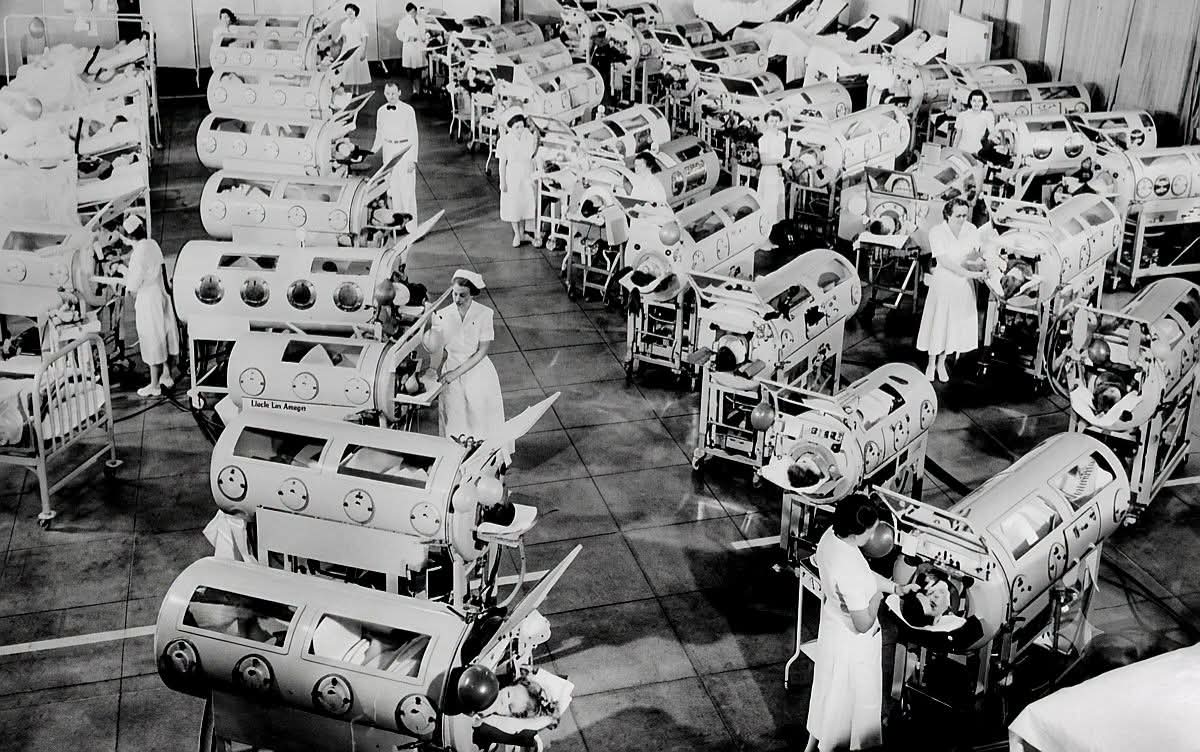 A hospital ward iron lungs caring for polio patients during the mid-20th century, before the widespread use of the polio vaccine.